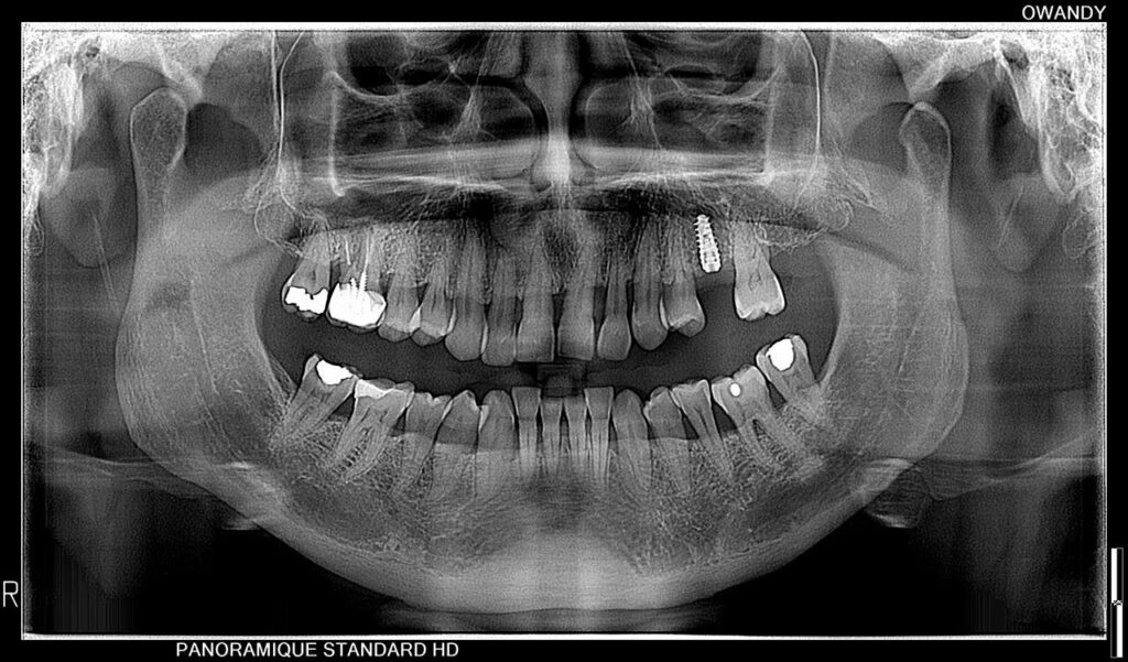 Panoramica dentale